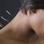 What can acupuncture effectively treat?